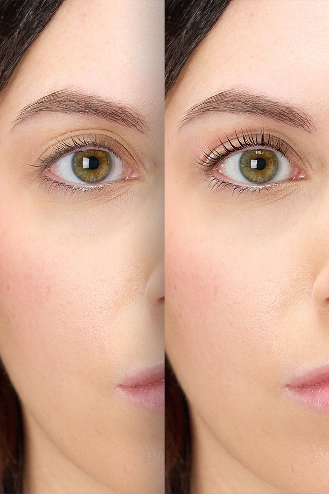 thebrash-occhio-dopo-1